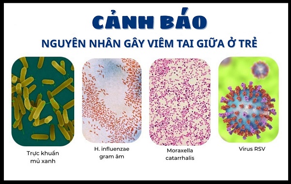 Trẻ bị viêm tai giữa? Nhận biết sớm – điều trị đúng – khỏi nhanh!