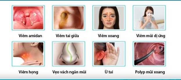 Phòng Khám Tai Mũi Họng Uy Tín Ở Bắc Ninh