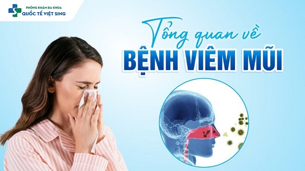 [GÓC HỎI – ĐÁP] Nên chữa viêm mũi như nào hiệu quả, an toàn?