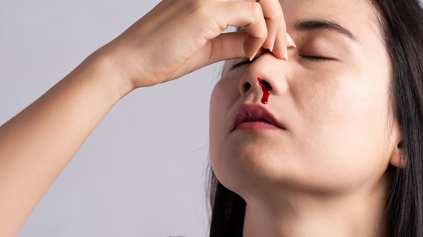Chảy máu mũi: Cảnh báo dấu hiệu bất thường không nên chủ quan