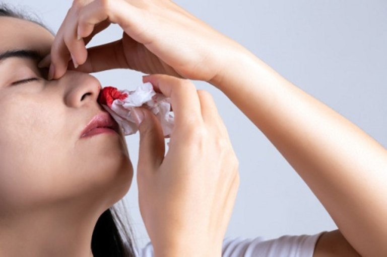 Nguyên nhân chảy máu cam và những điều quan trọng bạn cần biết!