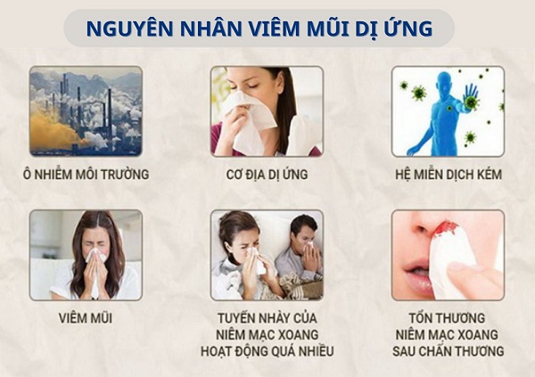 7 Dấu hiệu viêm mũi dị ứng thường gặp và cách nhận biết sớm
