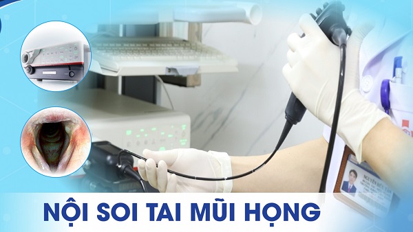 Nội soi tai mũi họng: Giải pháp cho kết quả chẩn đoán bệnh lý chính xác