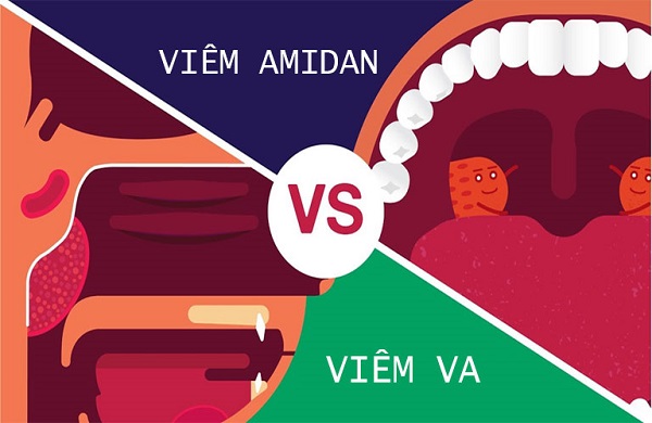 Bạn có biết: Viêm VA khác viêm amidan như thế nào chưa?