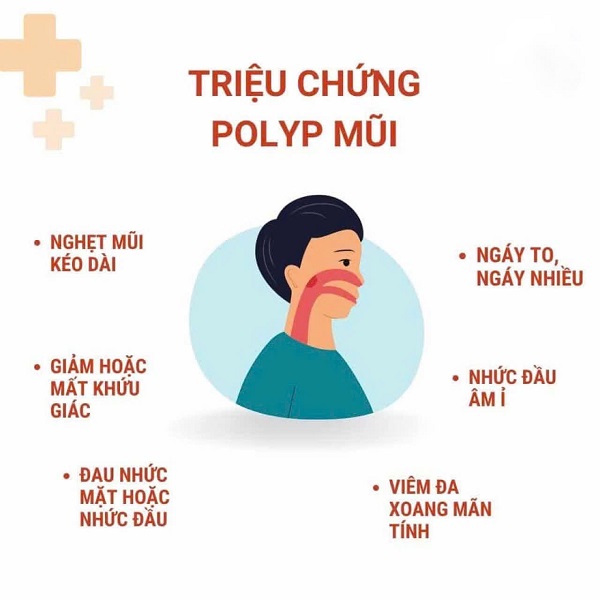 Bạn biết gì về căn bệnh polyp mũi? – Đọc hết bài viết sau để biết câu trả lời