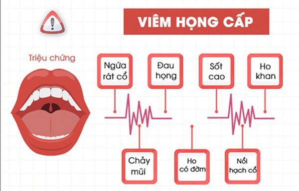 Phác đồ điều trị viêm họng và 3 nguyên tắc quan trọng cần lưu ý!