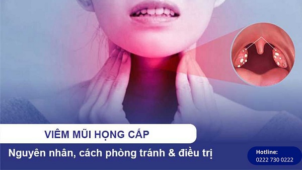Viêm mũi họng cấp: Phát hiện sớm – Điều trị kịp thời – Tránh biến chứng nguy hiểm