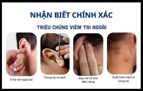 Đâu là phác đồ điều trị viêm tai ngoài hiệu quả? – Đọc hết bài viết sau để biết câu trả lời!