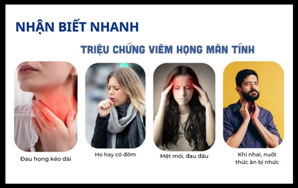Chữa biết viêm họng mãn tính là gì? – Tham khảo ngay bài viết này