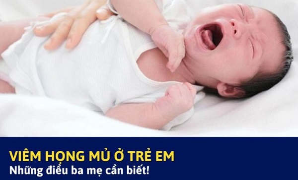 [Tổng quan] Viêm họng mủ ở trẻ em và những điều phụ huynh cần biết!