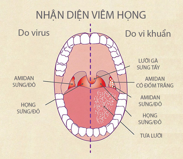 Tai mũi họng ở trẻ em và những điều cha mẹ cần phải biết