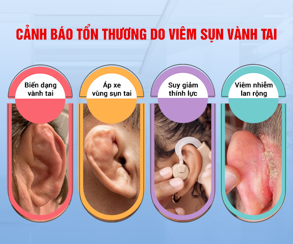 Có thể bạn sẽ bất ngờ với các yếu tố nguy cơ viêm sụn vành tai – Tìm hiểu ngay