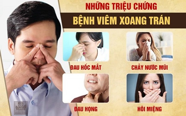 Viêm xoang trán và những điều quan trọng bạn cần biết!