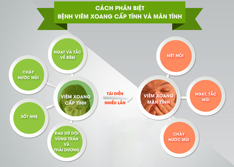 Viêm xoang mạn tính: Bệnh lý dai dẳng cần điều trị đúng cách từ sớm