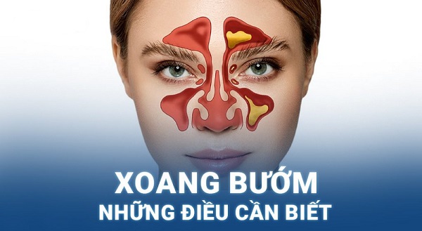 Viêm xoang bướm nguy hiểm thế nào? Chia sẻ từ bác sĩ chuyên khoa